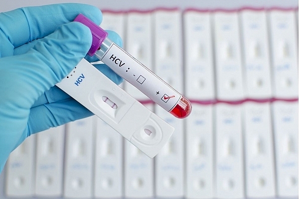 Hepatīts – dzīvībai bīstams arī bez simptomiem